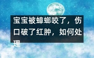 寶寶被蟑螂咬了，傷口破了紅腫，如何處理
